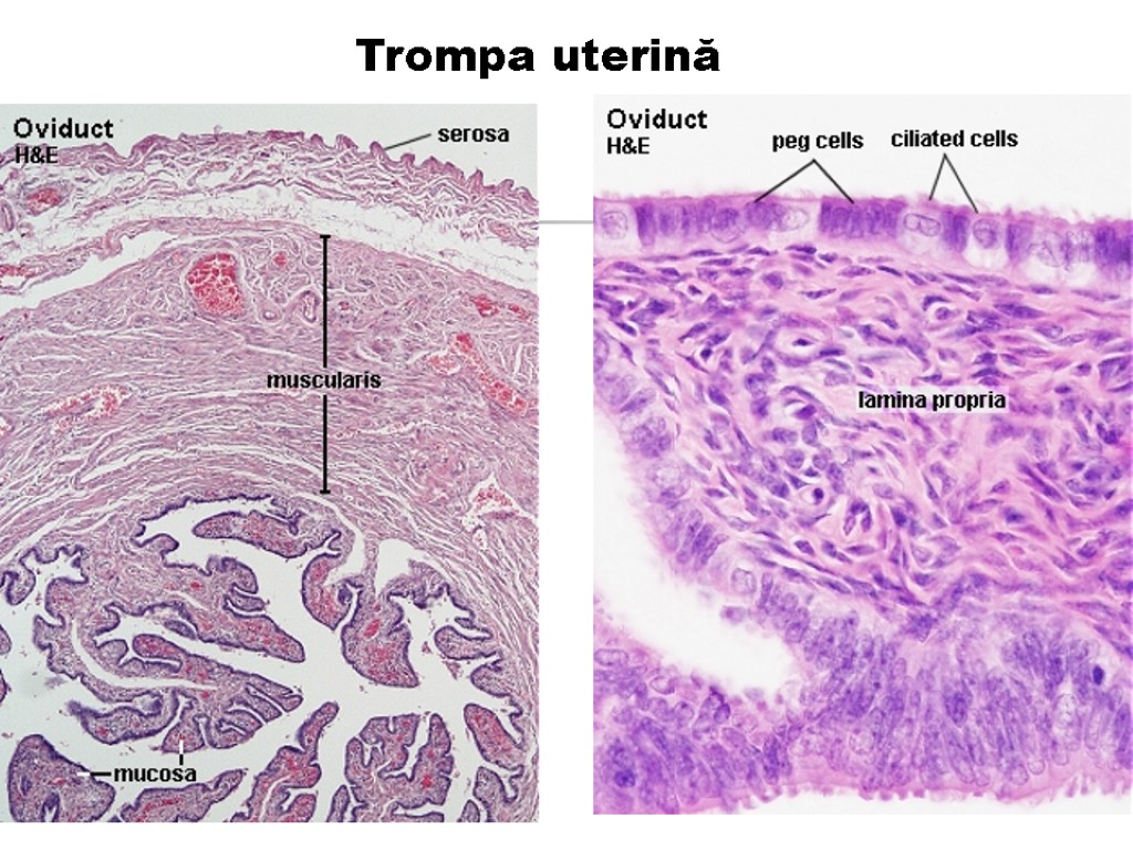 Trompa uterină